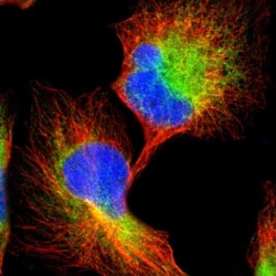 CLCC1 Antibody, Novus Biologicals 25 &mu;L; Unlabeled:Antibodies, Polyclonal